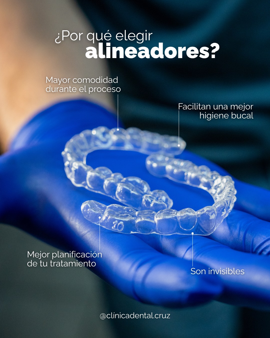 Pieza de Clínica Dental Cruz sobre por qué elegir alineadores